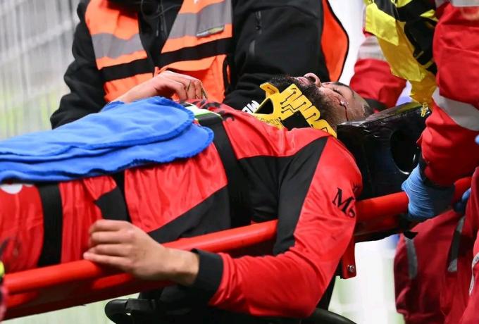 Χειρουργήθηκε ο Λόφτους-Τσικ, σημαντική απώλεια για Μίλαν