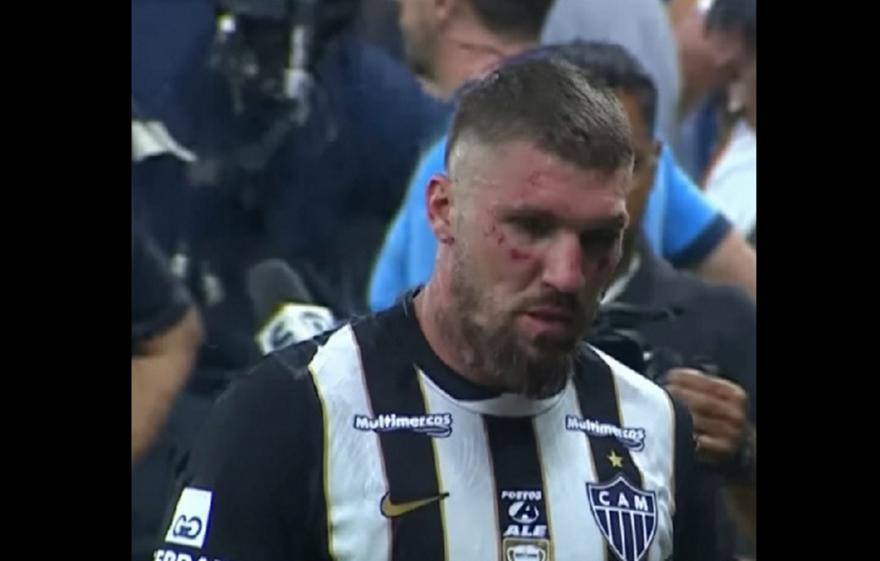 Ο Λιάνκο χτυπήθηκε από 7 διαφορετικούς αντιπάλους του!