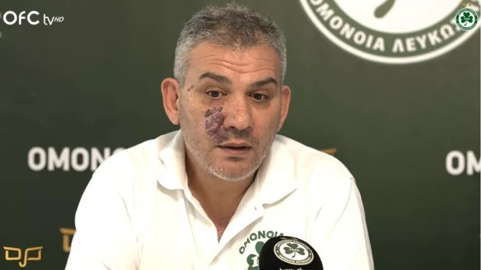 "Μετά την Ανόρθωση θα είμαστε έτοιμοι/Θα διεκδικήσουμε την είσοδο στους ομίλους του CL"