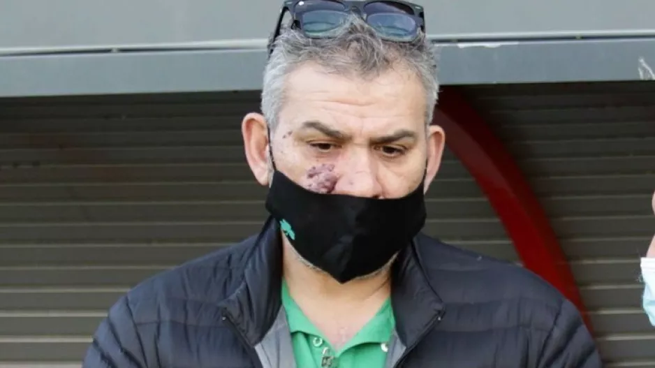 ΓΡΗΓΟΡΗ: “Η Ομόνοια θα ανακάμψει” 