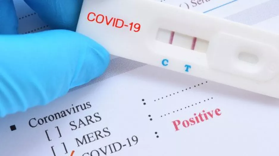 Rapid Tests: 48 θετικά/Που εντοπίστηκαν 