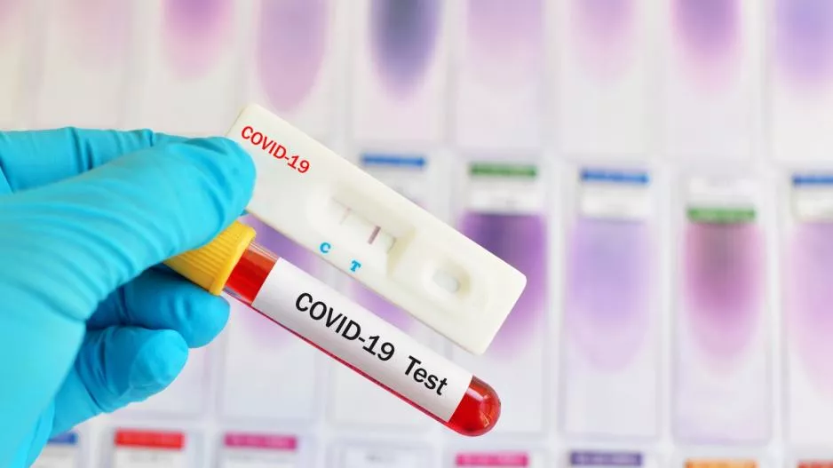 Rapid tests σε 15 σημεία αύριο Κυριακή