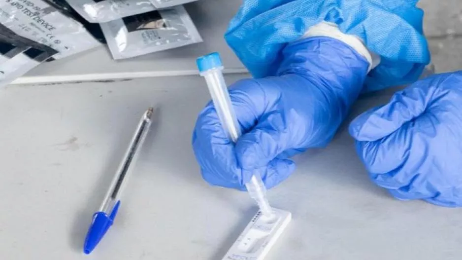 Τα σημεία γιa rapid test 11/1 - Πότε δικαιούσαι χωρίς Sms
