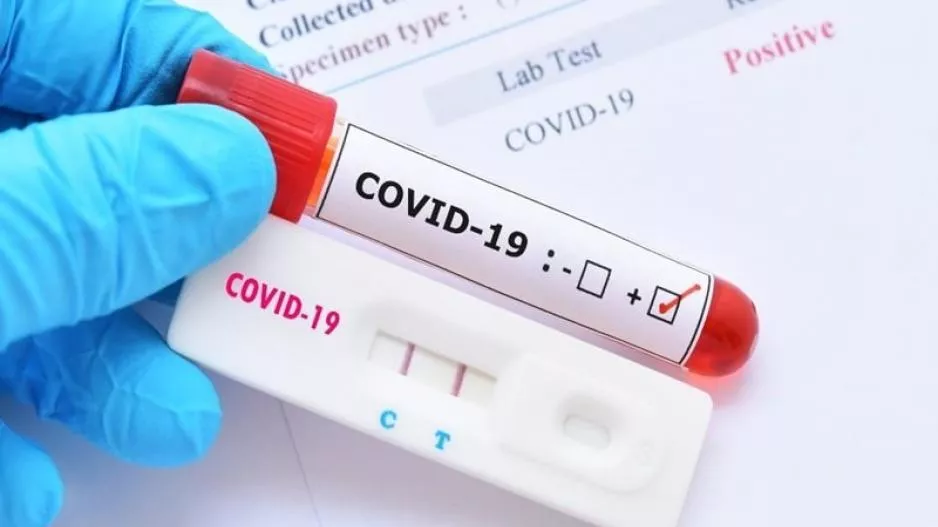 Αρχίζει ο έλεγχος με rapid test σε εργαζομένους - Πίνακας