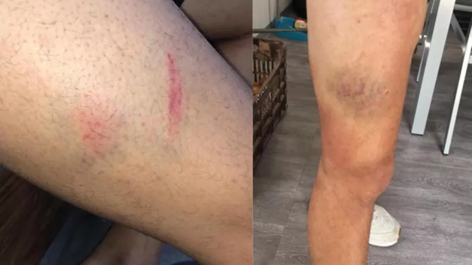 (ΦΩΤΟΣ) "Βίαιο χτύπημα, οι απειλές έγιναν πράξεις"