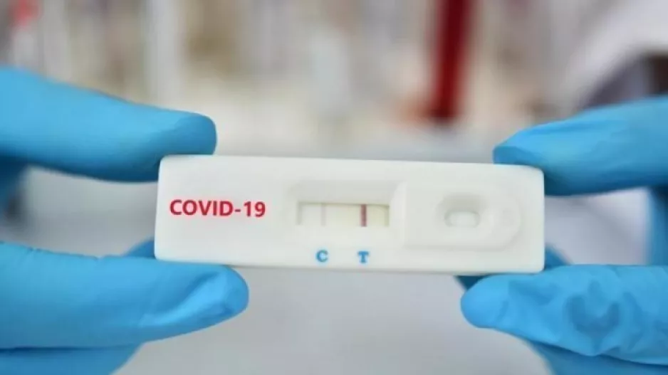 CB/ Rapid test για όσους θα εισέρχονται στο γήπεδο