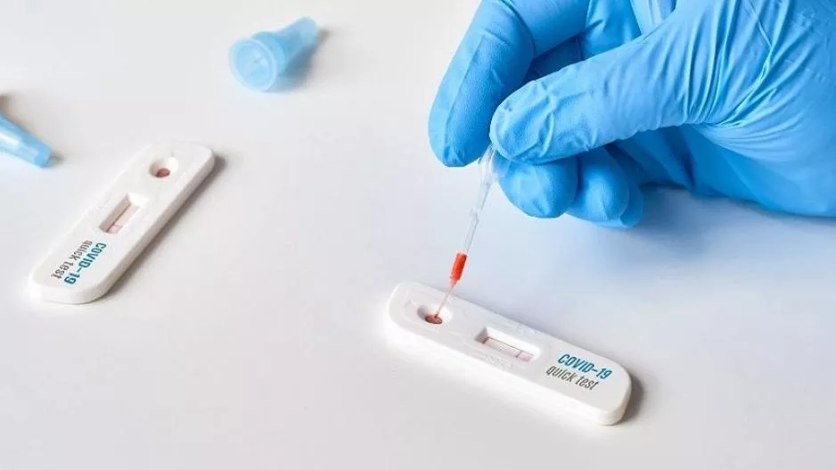 Τέλος τα δωρεάν rapid test από 1η Αυγούστου