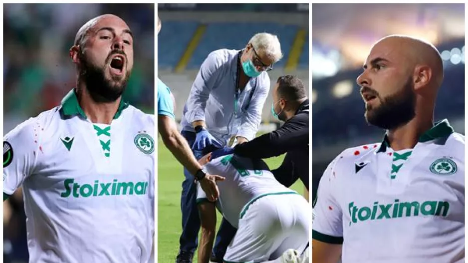 Mάτωσε ο Λέτσιακς, άλλαξε δύο φανέλες (Φώτος)