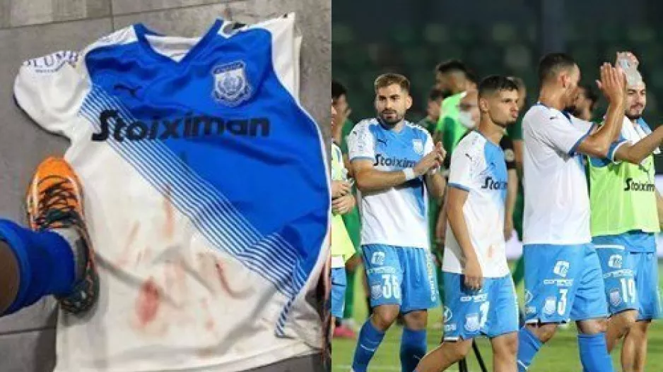 Απόλλων: Μάτωσε την φανέλα... κυριολεκτικά! 