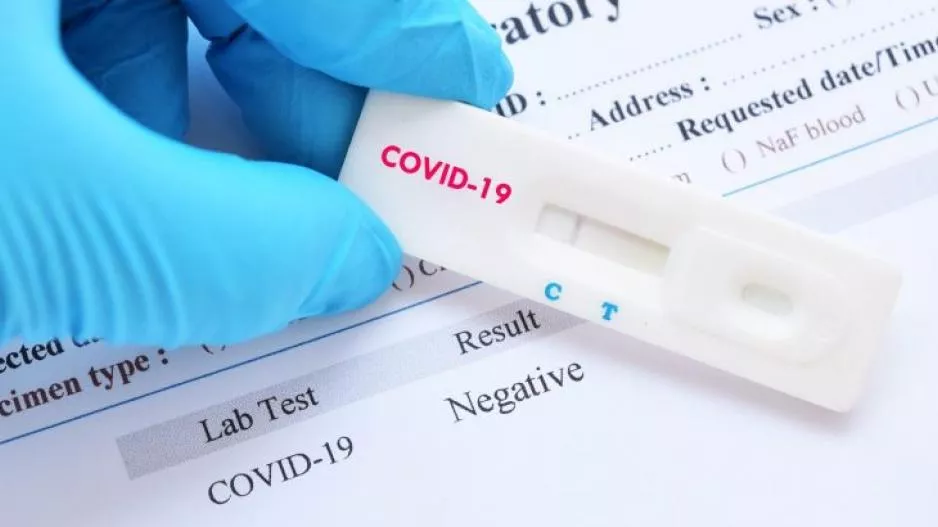 Πόσα κοστίζει σήμερα το PCR test