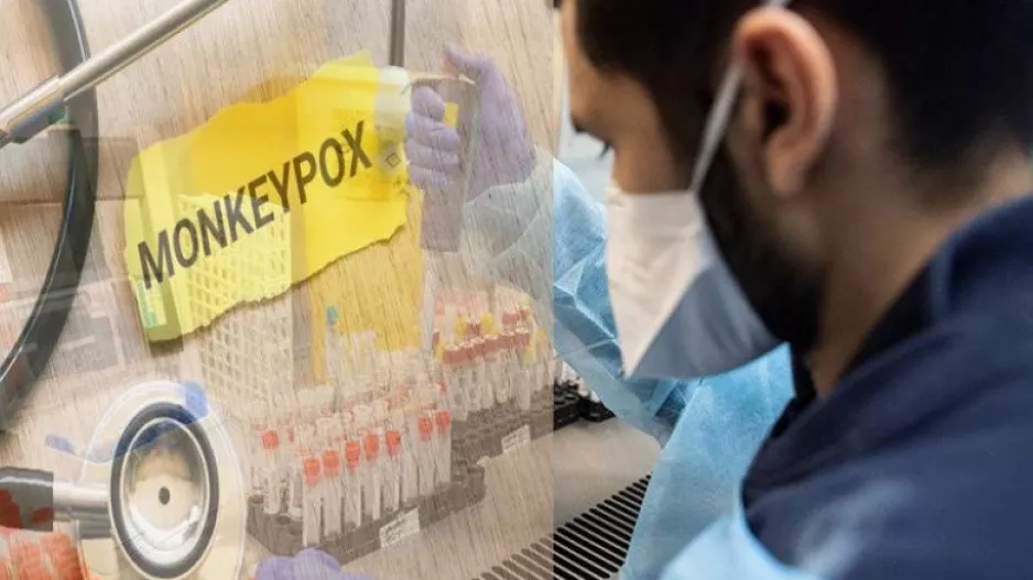 Έτοιμο το πλάνο για την ευλογιά των πιθήκων