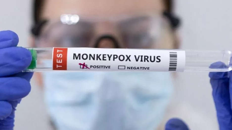 Πρώτο κρούσμα της ευλογιάς των πιθήκων στην Κύπρο