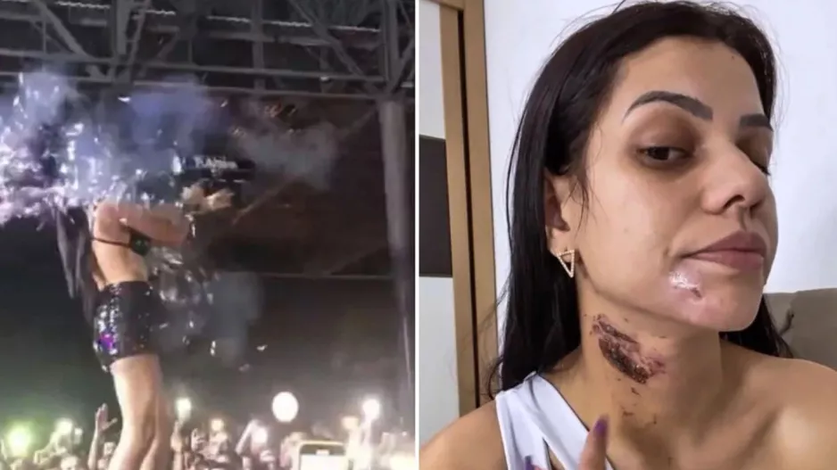 DJ τραυματίστηκε από «όπλο» με κομφετί - Έπαθε εγκαύματα πρώτου βαθμού