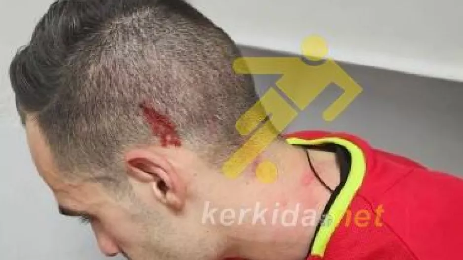 Σοβαρές καταγγελίες για ξυλοδαρμό απ' τον ρεφ του Άχνα - Π.Ο Αχυρώνα Ονήσιλου