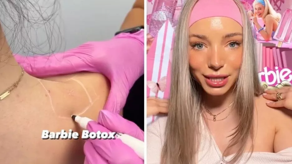 Barbie Botox, η νέα τάση που σαρώνει στο TikTok