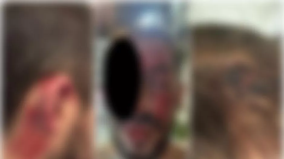 Σοβαρό επεισόδιο με τραυματισμό οπαδού του ΑΠΟΕΛ (Πληροφορίες Offsite)