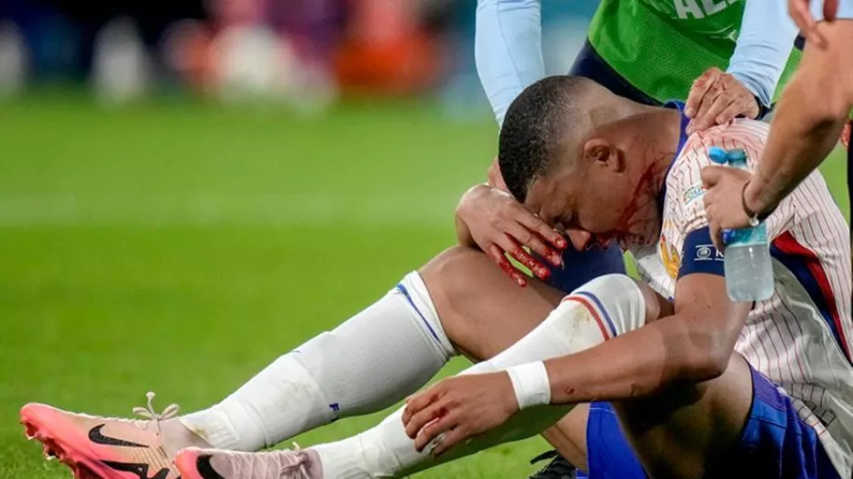 Με νέα μάσκα ο Εμπαπέ στην προπόνηση της Γαλλίας