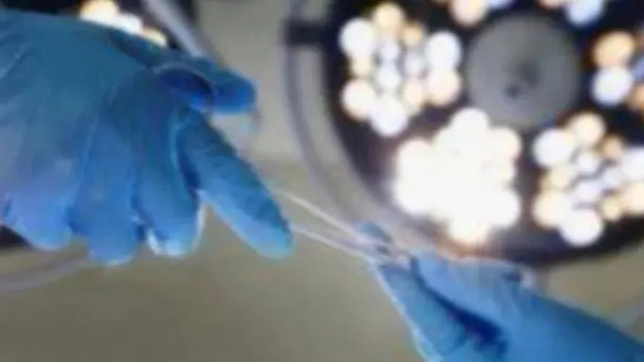Βραζιλία: 6 άτομα προσβλήθηκαν από τον ιό HIV μετά από μεταμόσχευση μολυσμένων οργάνων