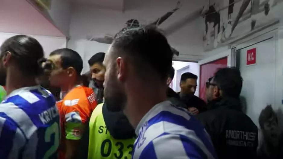 Η... άλλη κάμερα (ΑΝΟ)