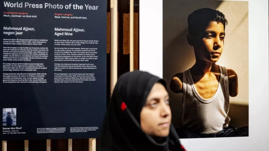 World Press Photo: Πρώτο βραβείο στη φωτογραφία ενός 9χρονου ακρωτηριασμένου Παλαιστίνιου