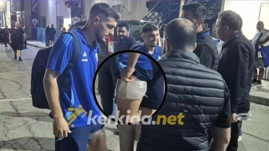 Με πάγο στον αριστερό μηρό ο Αρτυματάς - Κουβέντα με τη Διοίκηση