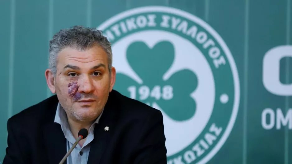 "Δεν θα πω ονόματα"!