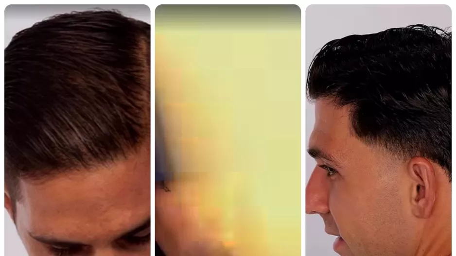 (ΑΠΟΕΛ)/Επετειακά, με βίντεο promo