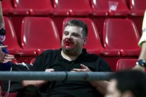 ΣΟΚΑΡΙΣΤΙΚΕΣ εικόνες με τα "ανοιγμένα" κεφάλια στου Ρέντη (Φώτος)
