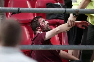 ΣΟΚΑΡΙΣΤΙΚΕΣ εικόνες με τα "ανοιγμένα" κεφάλια στου Ρέντη (Φώτος)