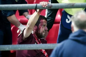 ΣΟΚΑΡΙΣΤΙΚΕΣ εικόνες με τα "ανοιγμένα" κεφάλια στου Ρέντη (Φώτος)