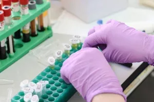 14 νέα κρούσματα στην Κύπρο