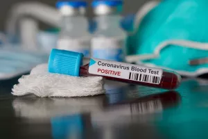 Ακόμα ένας θάνατος και 32 νέα θετικά κρούσματα
