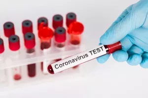 ΕΛΛΑΔΑ/Τρεις θάνατοι και 17 νέα κρούσματα 
