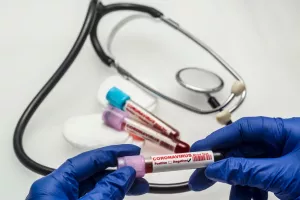 Πάφος - Αραδίππου: Προγραμματισμένες 1,525 δειγματοληψίες
