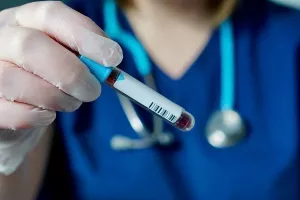 Είκοσι νέα κρούσματα κορωνοϊού/Θάνατος 76χρονου με πολύ βεβαρημένο ιστορικό