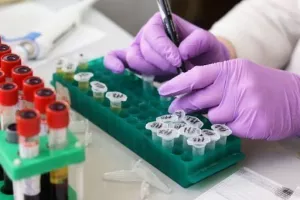 Μηδέν κρούσματα και σήμερα στα κατεχόμενα