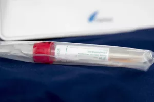 Επιστήμονες ανακάλυψαν αντίσωμα που μπλοκάρει τη μόλυνση από κορωνοϊό
