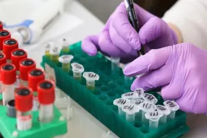 Πόσα κρούσματα στην Κύπρο ενδεχομένως να μην έχουν ανιχνευθεί/ΔΗΛΩΣΗ