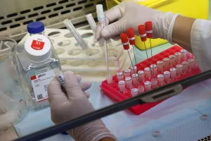 Ακόμα ΤΕΣΣΕΡΑ κρούσματα στην Κύπρο