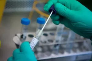 ΜΕΙΩΣΗ σε Αρμενία/23 νέα κρούσματα