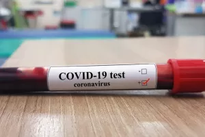 152 νέα κρούσματα στην Κύπρο 