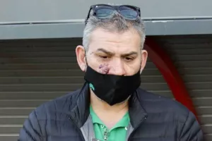 ΓΡΗΓΟΡΗ: “Η Ομόνοια θα ανακάμψει” 