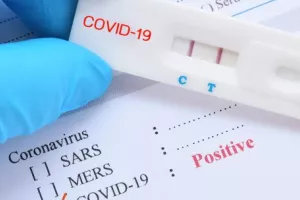 Rapid Tests: 48 θετικά/Που εντοπίστηκαν 