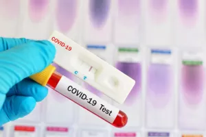 Rapid tests σε 15 σημεία αύριο Κυριακή