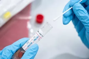 ΚΥΠΡΟΣ/Δυο θάνατοι, 242 κρούσματα (+180 από rapid)
