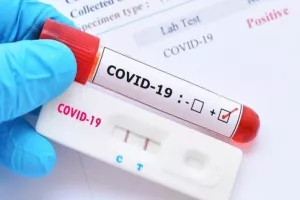 Αρχίζει ο έλεγχος με rapid test σε εργαζομένους - Πίνακας