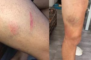 (ΦΩΤΟΣ) "Βίαιο χτύπημα, οι απειλές έγιναν πράξεις"