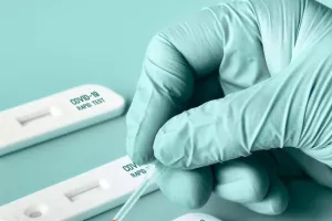 Δήλωση/Fake news τα δωρεάν rapid test από Μητρόπολη Μόρφου