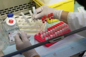 (Κύπρος) Επικρατεί η Ινδική μετάλλαξη, δεν έχει εντοπιστεί η "Mu"
