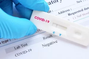 Πόσα κοστίζει σήμερα το PCR test